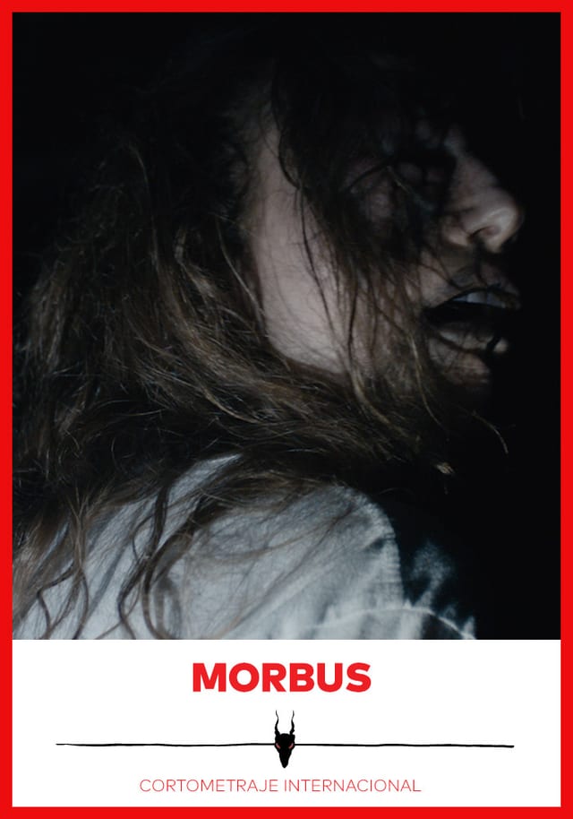 Morbus